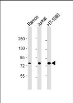 GARS Antibody in Western Blot (WB)