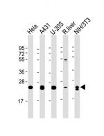 RAB1B Antibody in Western Blot (WB)