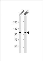 PRDM16 Antibody in Western Blot (WB)