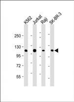 c-Cbl Antibody in Western Blot (WB)