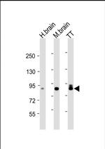 DCLK1 Antibody in Western Blot (WB)