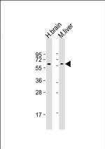 GLS2 Antibody in Western Blot (WB)