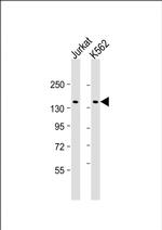 KANK1 Antibody in Western Blot (WB)