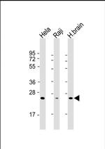 RAB14 Antibody in Western Blot (WB)