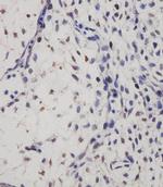 SUFU Antibody in Immunohistochemistry (Paraffin) (IHC (P))