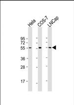 SUFU Antibody in Western Blot (WB)