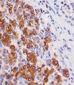 REG3G Antibody in Immunohistochemistry (Paraffin) (IHC (P))