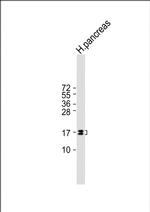 REG3G Antibody in Western Blot (WB)