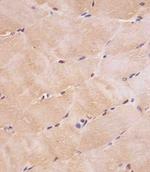 SMAD1 Antibody in Immunohistochemistry (Paraffin) (IHC (P))