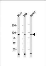 HK2 Antibody in Western Blot (WB)