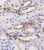 ME2 Antibody in Immunohistochemistry (Paraffin) (IHC (P))