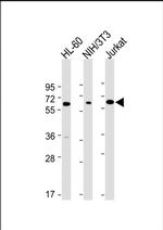 ME2 Antibody in Western Blot (WB)