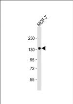 ABCB4 Antibody in Western Blot (WB)