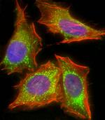 HIF1AN Antibody in Immunocytochemistry (ICC/IF)