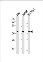 HIF1AN Antibody in Western Blot (WB)