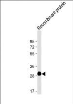 ROS1 Antibody in Western Blot (WB)