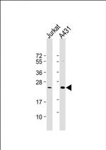 RAB29 Antibody in Western Blot (WB)