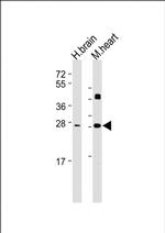 DKK2 Antibody in Western Blot (WB)