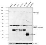 TSG101 Antibody in Western Blot (WB)