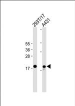 UBE2C Antibody in Western Blot (WB)