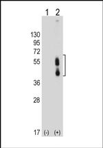 CD273 (B7-DC) Antibody in Western Blot (WB)