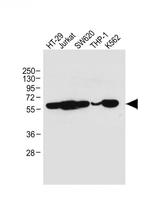 RIP3 Antibody in Western Blot (WB)