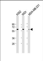 NUP54 Antibody in Western Blot (WB)