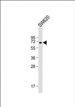 HAS2 Antibody in Western Blot (WB)