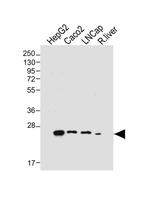 GSTA1 Antibody in Western Blot (WB)