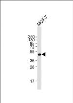 SULT2B1 Antibody in Western Blot (WB)