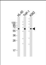 CARD9 Antibody in Western Blot (WB)