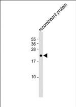 FGF4 Antibody in Western Blot (WB)