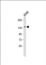 DAPK1 Antibody in Western Blot (WB)