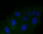 DFNA5 Antibody in Immunocytochemistry (ICC/IF)