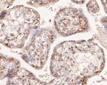 NFkB p52/p100 Antibody in Immunohistochemistry (Paraffin) (IHC (P))