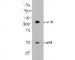 NFkB p52/p100 Antibody in Western Blot (WB)