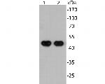 SARS-CoV-2 Nucleocapsid Antibody in Western Blot (WB)