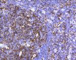 CD45 Antibody in Immunohistochemistry (Paraffin) (IHC (P))