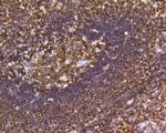 CD45 Antibody in Immunohistochemistry (Paraffin) (IHC (P))