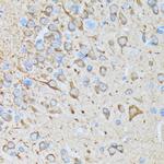 CaMKII Pan Antibody in Immunohistochemistry (Paraffin) (IHC (P))