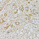 CaMKII Pan Antibody in Immunohistochemistry (Paraffin) (IHC (P))