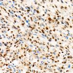 TFE3 Antibody in Immunohistochemistry (Paraffin) (IHC (P))