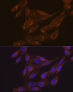 PIST Antibody in Immunocytochemistry (ICC/IF)