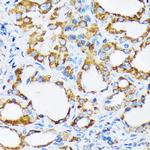 PIST Antibody in Immunohistochemistry (Paraffin) (IHC (P))