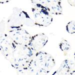 RCC1 Antibody in Immunohistochemistry (Paraffin) (IHC (P))