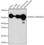 MAGE1 Antibody in Western Blot (WB)