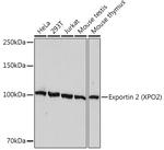 CAS Antibody in Western Blot (WB)