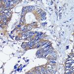 PKC alpha Antibody in Immunohistochemistry (Paraffin) (IHC (P))