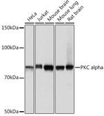 PKC alpha Antibody in Western Blot (WB)