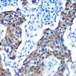 p16INK4a Antibody in Immunohistochemistry (Paraffin) (IHC (P))